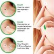 Picture of DOT STICKER  Invisible Hydrocolloid Pimple Tag Remover for Face Skin SKIN TAG ACNE PATCH