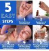 Picture of Facial Cupping Set Silicone Vacuum Suction  Cupping Massage Therapy