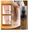 Picture of Varicose Veins Spray Varicose Veins Spray – Natural Herbal Formula for Fast Relief  Reduces Swelling, Relieves Pain & Promotes Blood Circulation