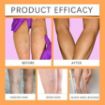 Picture of Varicose Veins Spray Varicose Veins Spray – Natural Herbal Formula for Fast Relief  Reduces Swelling, Relieves Pain & Promotes Blood Circulation