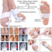 Picture of Bunion Splint Pad Toe straightener bunion corrector splint with toe fracture support and foot support