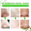 Picture of Nose Strips  Blackhead Strips