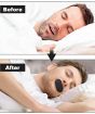 Picture of Black Sleep Strips BREATH FIX Mouth Tape  Mouth Tape Nasal Breathing  Breath Fix Mouth Tape Mouth Strips 30 PCS Mouth Tape