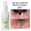 Picture of Anti Fungal Cream Fungal Cream Fungal Malam  Skin Care Cream ungal Malam for Ringworm itching Eczema cream