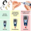 Picture of Blood Sugar Control Ring  Sugar Control Ring Blood Glucose Control Rin