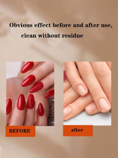 Picture of NAIL REMOVAL WET WIPES (100 PC)