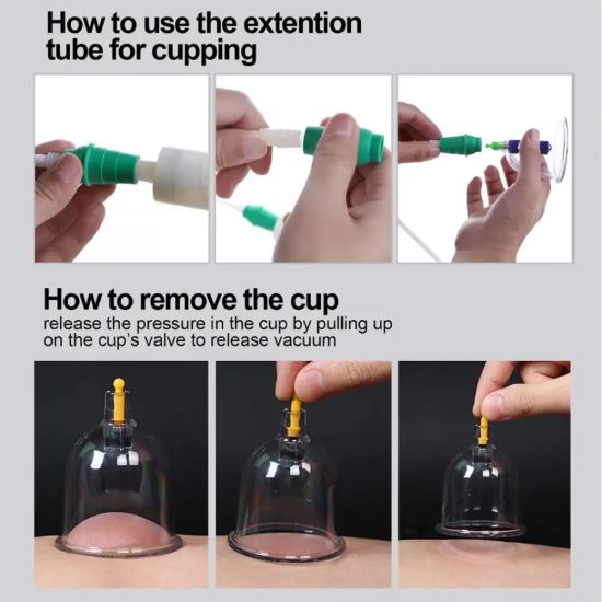 Picture of 12 CUPS SETS FOR CUPPING MASSAGER