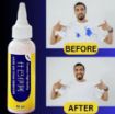Picture of Hard Ink Stain Remover  Premium Ink Cleaner for Clothes Stain Remover