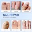 Picture of NAIL PATCHES