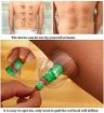 Picture of 12Pcs Massage Cans Cups Chinese Vacuum Cupping Kit Pull Out Vacuum Apparatus Therapy Relax Massagers VACUUM MASSAGER