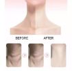 Picture of Face Firming Wrinkle Removal Tool Thërapy Neck Massager 3 Led Heat Vibration Anti Aging Skin Care Beauty Machine for Tighten Skin