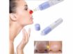 Picture of Facial Pore Cleanser pore cleaner Blackhead Remover Vacuum Suction Cleansing Tool Electric Blackhead Remover